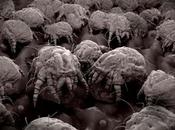 Natural Ways Dust Mites Your Home