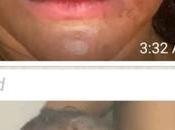 First Photos Angela Okorie Emerge Pellets Bullet Were Allegedly Removed from Hair