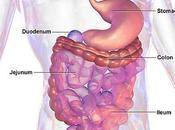 Gastroparesis It’s Natural Treatment