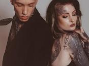 Complete Beginner’s Guide Laser Tattoo Removal