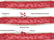 Treatment Afibrinogenemia Ayurveda