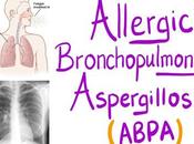 Alternative Treatment Allergic Bronchopulmonary Aspergillosis (ABPA)