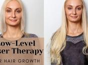 Low-Level Laser Therapy Hair Growth Things Should Know