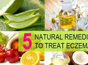 Some Home Remedies Preventive Measures Eczema