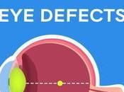 Treat Myopia Through Ayurveda?