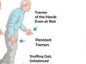 Parkinson’s Disease