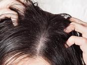 Best Scalp Head Care Solutions