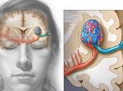 Herbal Remedies Arteriovenous Malformation