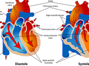 Ketogenic Diet Cardiovascular Disease: Risks?