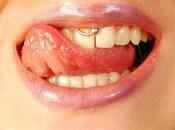 Know More About Smiley (Frenulum) Piercing