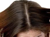 Stop Hair Loss Women?