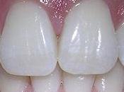 Works Made With Teeth