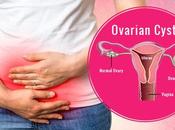 Natural Tips Treat Cysts Treatment Home