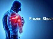 Frozen Shoulder: Kandhe Akdan