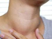 Diet Home Remedies Goiter