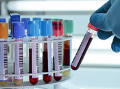 Handle High Levels With Ayurveda?