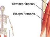 Biceps Femoris Tendonitis Stem Cell Treatment: Hamstring Treatment Options