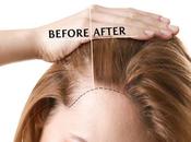 Prevent Hair Thinning?