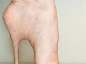 Human Skin Stiletto Implants: Body Enhancement That Beyond Creepy