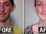 Children Plastic Surgery