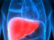Liver Associated Diseases