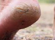 Padadari Cracked Heals