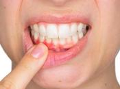 Common Dental Problems What About Them