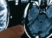 Research Shows COVID-19 Alters Gray Matter Volume Brain