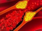 Alert: Knowing This Prevent Cholesterol Problems Forever