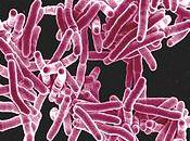 Rates Drug Resistant Tuberculosis Rise
