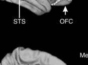 Enhancing Social Ability with Brain Stimulation.