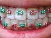 Brace Yourself: Wearing Braces Fashion Trend