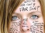 White Skin Unfair?