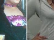 Lakeeta’s Before After Gastric Bypass Photos Story