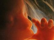 Human Life, from Conception Birth