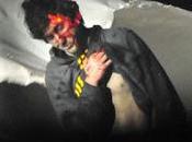Chilling Photos Released Boston Bombing Suspect Covered Blood (Video)