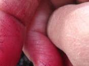 Blackberries: Pain Pleasure