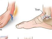 Ankle Pain Injury Augusta