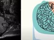 Midazolam Ketamine Produce Distinct Neural Changes Memory, Pain, Fear Networks During Pain