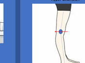 Knee Hyperextension Symptoms, Causes, Prevention Treatment Options