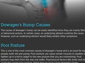 Dowager’s Hump: Symptoms, Causes Treatment