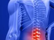 What Superion Patients Have Spinal Stenosis?