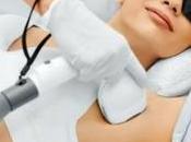 Does Laser Hair Removal Work?
