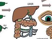 Natural Cure Klebsiella Sepsis
