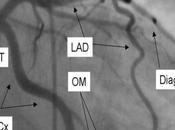 Natural Treatment Bernard Soulier Syndrome