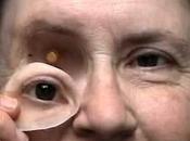 Ocular Implant Market Represent Healthy Growth 2027 COVID-19 Impact