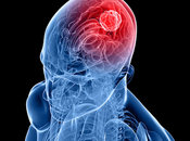 PARP Inhibitor Market Expected Expand Recording Stable CAGR Over Covid-19 Analysis Forecast Year 2026