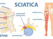 Self-care Sciatica: Home Remedies Back Pain