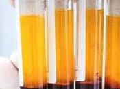 Global Platelet Rich Plasma Market Size Applications, Product, Origin, Geographic Scope Forecast 2020 2027