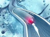 Angioplasty Balloons Market Size, Share, Trend Analysis Competition Tracking, Forecast 2018-2026